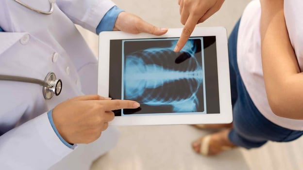 Doctor holding tablet showing xray results